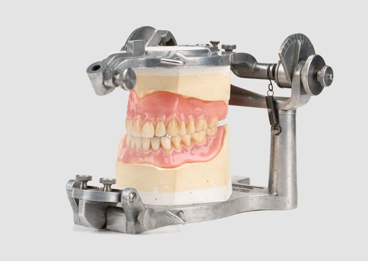 A silver clamp holding a photo of a set of teeth