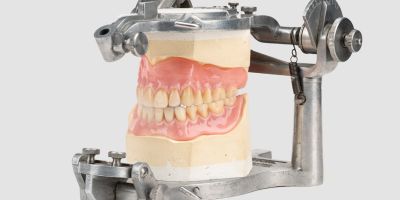 A silver clamp holding a photo of a set of teeth