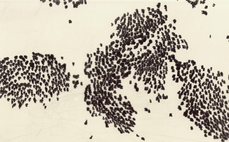 A laptopogram displaying a dataset as cloud-like clusters of black blobs on a neutral background. There are three larger collections, almost resembling a map, with some data points leaking out into the negative space.